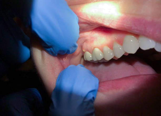 Best Weekend Emergency Dentist in Cranston, RI