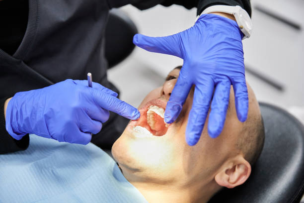 Best Emergency Tooth Extraction in Cranston, RI